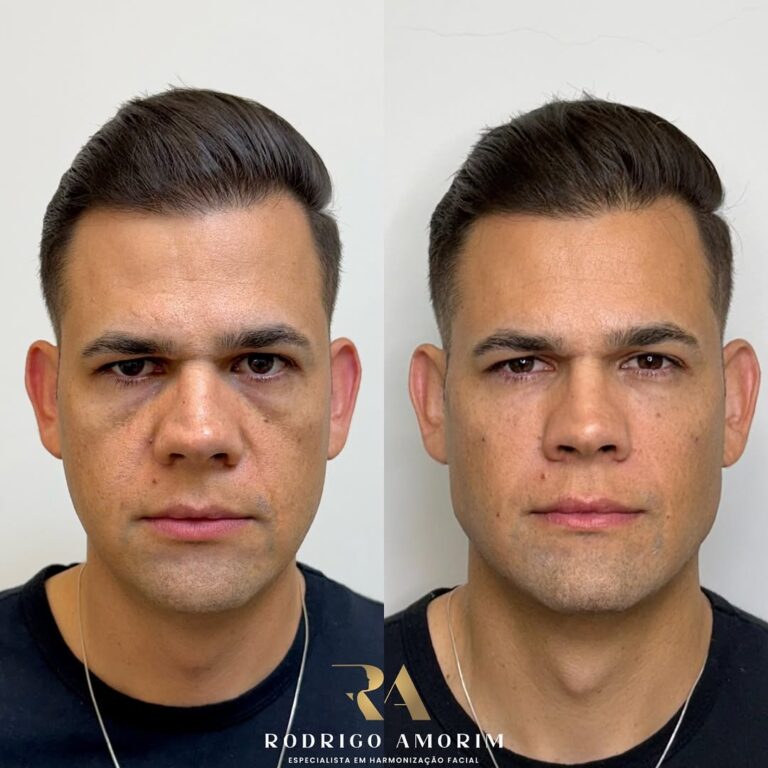 Snapinsta.app_467028911_18469748467023673_6232221535551229674_n_1080