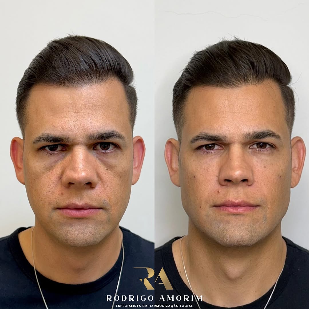 Snapinsta.app_467028911_18469748467023673_6232221535551229674_n_1080