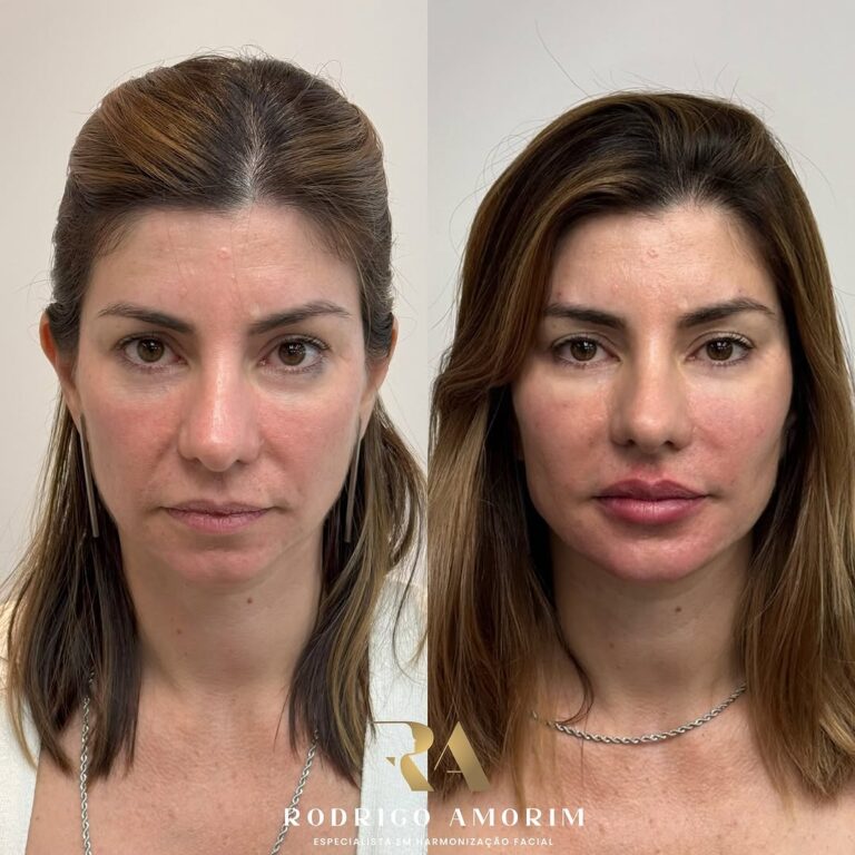 Snapinsta.app_467800294_18470980759023673_7090473141711878983_n_1080